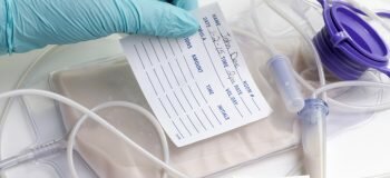 Magensonde: Zwangsernährung am Lebensende ist unnötig