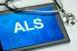 Diagnose ALS Weltweit erkranken jährlich ca. 120.000 Personen an ALS. Foto: Fotolia